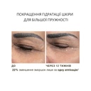 до і після - патчі під очі Hyaluronic Acid Microneedle Eye Patches